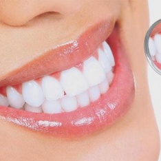 RĂNG SỨ CAO CẤP KATANA